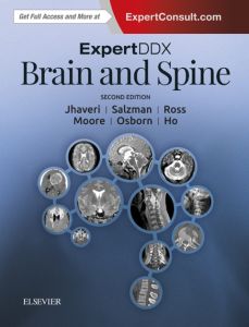 ExpertDDx: Brain and Spine E-Book