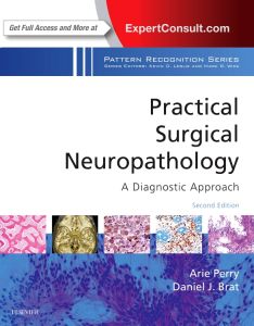 Practical Surgical Neuropathology: A Diagnostic Approach