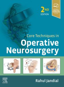 Core Techniques in Operative Neurosurgery E-Book
