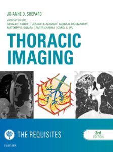 Thoracic Imaging The Requisites E-Book