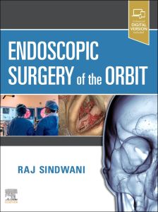 Endoscopic Surgery of the Orbit