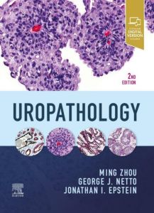 Uropathology E-Book