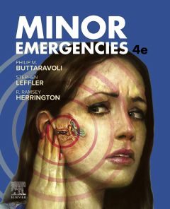 Minor Emergencies E-Book
