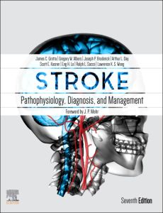 Stroke E-Book