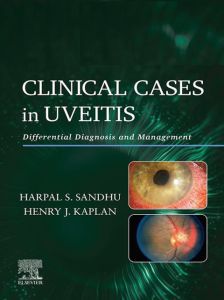 Clinical Cases in Uveitis E-Book