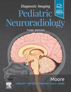 Diagnostic Imaging: Pediatric Neuroradiology E-Book
