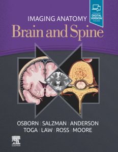 Imaging Anatomy Brain and Spine, E-Book