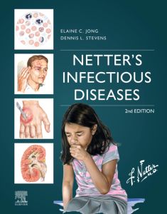 Netter's Infectious Diseases - E-Book