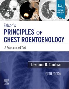 Felson's Principles of Chest Roentgenology E-Book