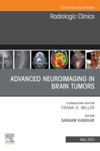 Advanced Neuroimaging in Brain Tumors, An Issue of Radiologic Clinics of North America, E-Book