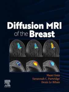 DIFFUSION MRI OF THE BREAST, E-Book