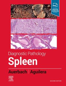 Diagnostic Pathology: Spleen