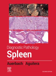 Diagnostic Pathology: Spleen - E-Book