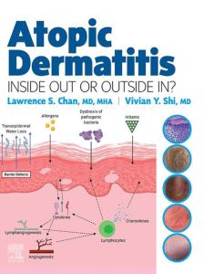 Atopic Dermatitis: Inside Out or Outside In - E-Book