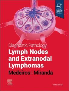 Diagnostic Pathology: Lymph Nodes and Extranodal Lymphomas