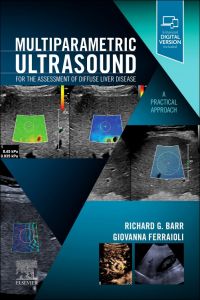 Multiparametric Ultrasound for the Assessment of Diffuse Liver Disease