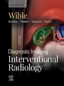Diagnostic Imaging: Interventional Radiology E-Book