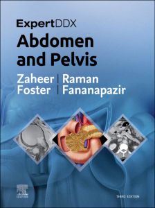 ExpertDDx: Abdomen and Pelvis E-Book