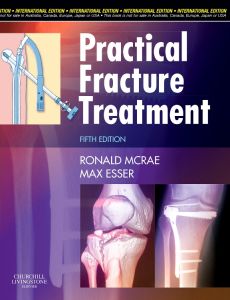 Practical Fracture Treatment, International Edition