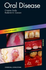 Oral Disease E-Book