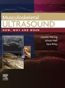Musculoskeletal Ultrasound, E-Book