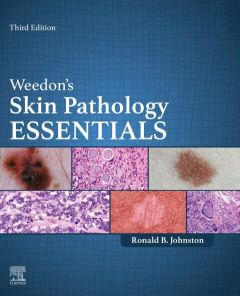 Weedon's Skin Pathology Essentials - E-Book
