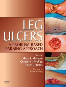 Leg Ulcers E-Book