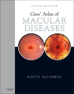 Gass' Atlas of Macular Diseases