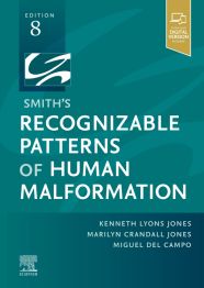 Smith's Recognizable Patterns of Human Malformat: 8th edition ...