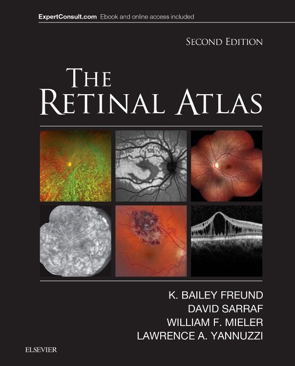 Retinal Detachment NYC - Vitreous Retina Macula Consultants of New