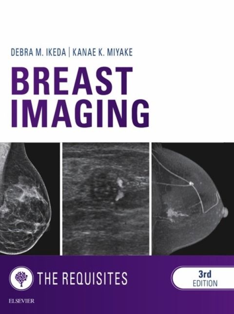 E-Book:　Asia　Breast　ISBN:　Ikeda　9780323391573　Imaging:　Debra　The　3rd　Requisites　edition　Elsevier　Bookstore